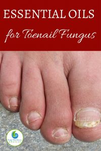 Best Essential Oils for Toenail Fungus