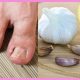 Natural Remedies for Nail Fungus