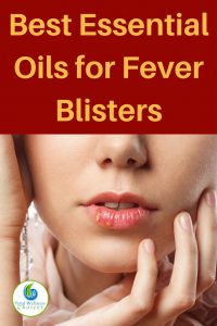 Best Essential Oils for Fever Blisters