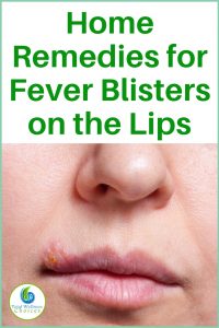 Home Remedies for Fever Blisters on the Lips