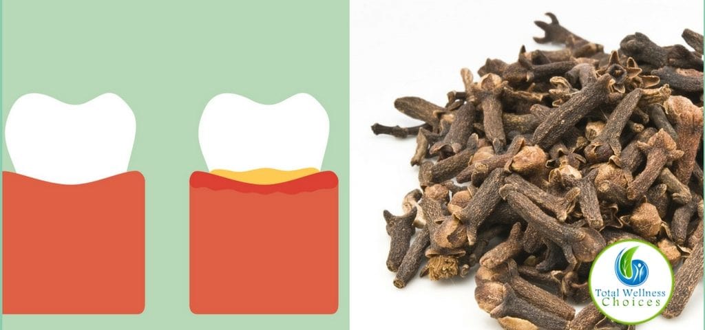 Use Clove Oil Tooth Pain