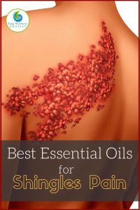 Best Essential Oils for Shingles Pain