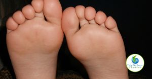 Essential Oil Athlete Foot