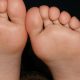 Essential Oil Athlete Foot