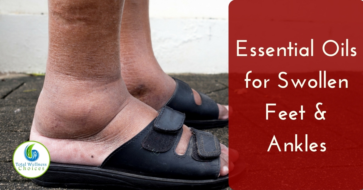 Top 5 Essential Oils For Swollen Feet And Ankles To Reduce Swelling Top 5 Essential Oils For Swollen Feet And Ankles To Reduce Swelling