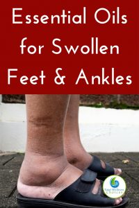 Best Essential Oils for Swollen Feet and Ankles