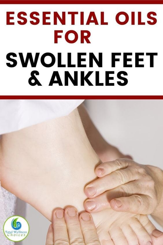 swollen feet essential oils