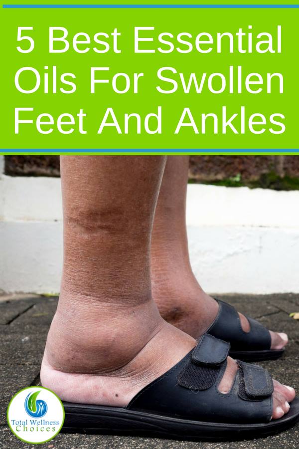 If you suffer from swollen feet and ankles, you need to look at these home remedies made with essential oils. Foot soaks and massages are natural ways to help reduce swelling in your feet and legs when combined with Eos and other natural ingredients. #swollenfeet #feet #tiredfeet #essentialoils #cypress #helichrysum #juniper #lavender #peppermint