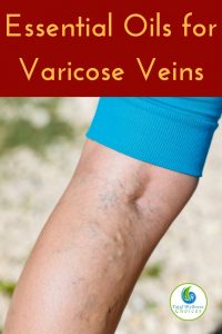 Best Essential Oils for Varicose Veins