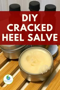 Diy Cracked Heel Salve