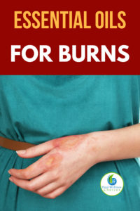 Best Essential Oils for Burns