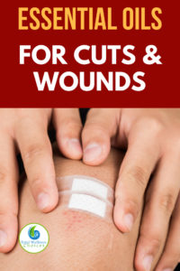 Best Essential Oils for Cuts, Wounds, Scrapes and Bruises