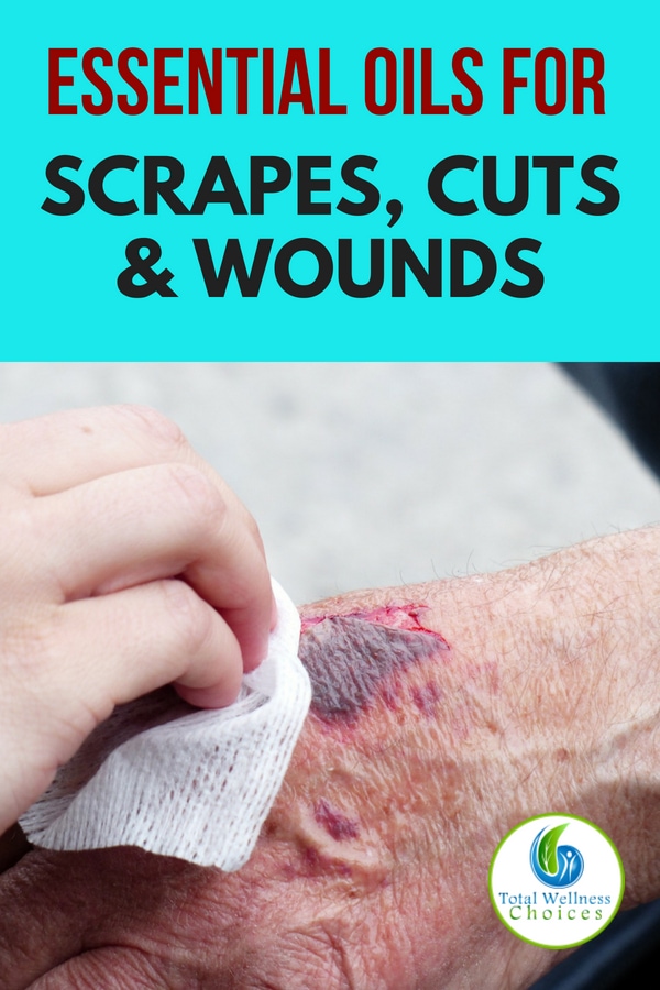 Essential Oils for Scrapes Cuts Wounds