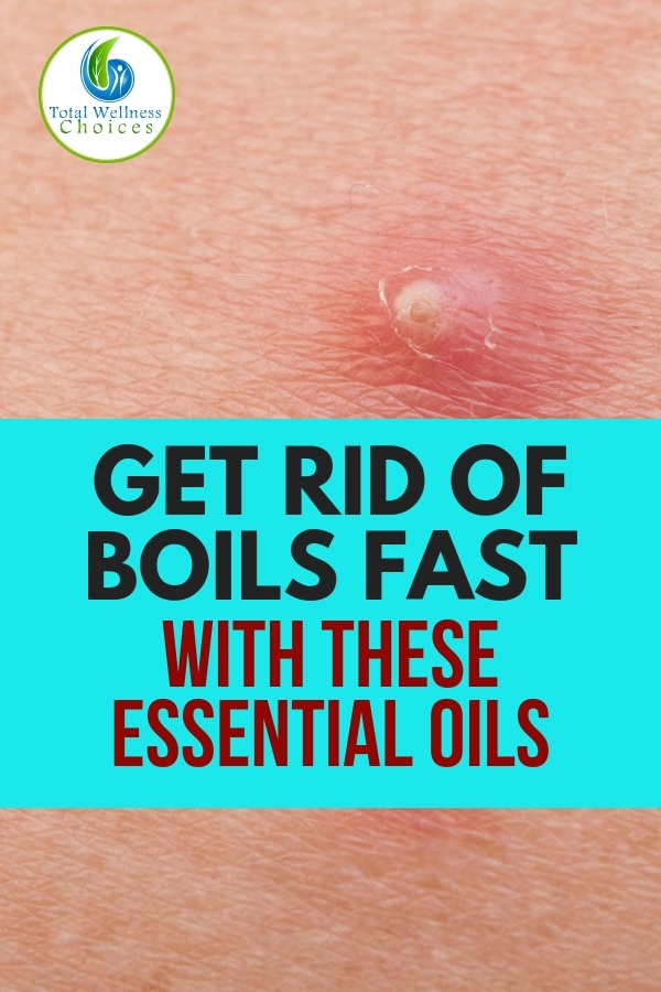 Looking for a natural home remedy or treatment for boils on the skin? Find out how to get rid of boils fast with essential oils. #getridofboils #boilsonskin #naturalremedies #naturaltreatments #homeremedies #essentialoils #abscesses