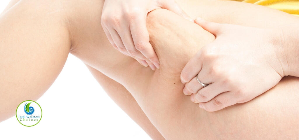 Essential oils for cellulite removal