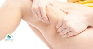 Essential oils for cellulite removal