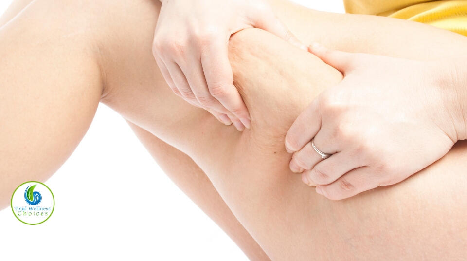 Essential oils for cellulite removal