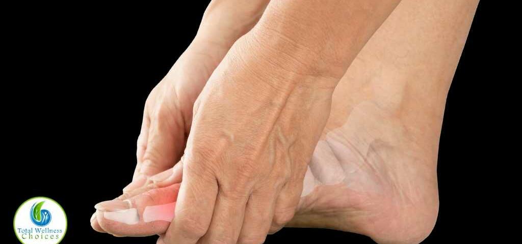Essential oils for gout relief