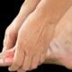 Essential oils for gout relief