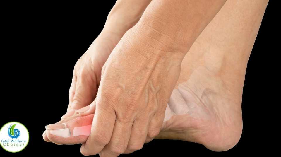 Essential oils for gout relief